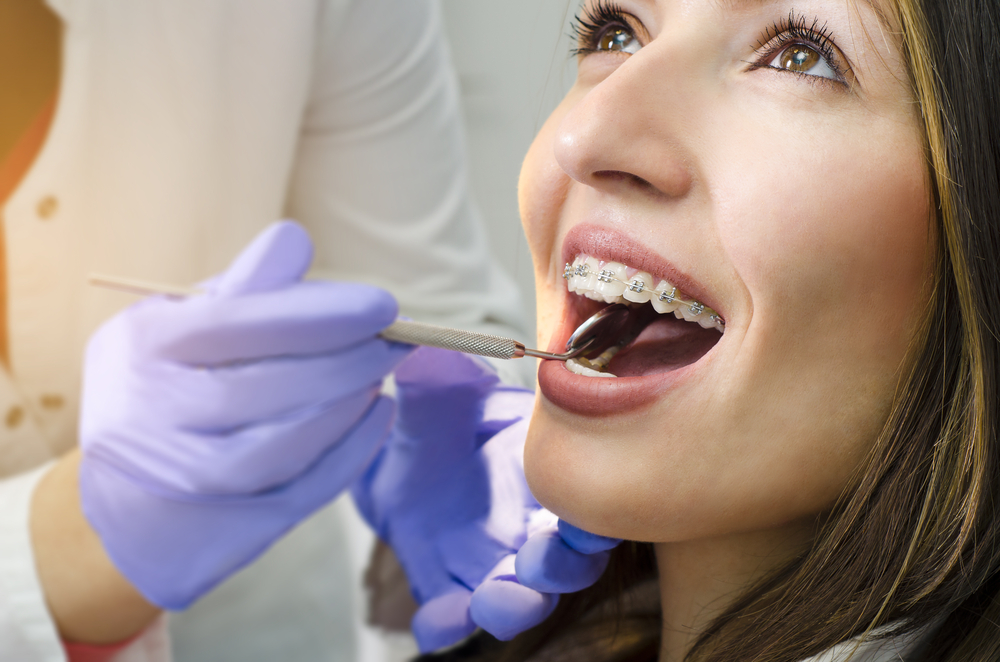 orthodontic treatment